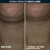 RoC Derm Correxion Firming Neck Cream with Hyaluronic Acid & Advanced Retinol