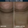 RoC Derm Correxion Firming Neck Cream with Hyaluronic Acid & Advanced Retinol