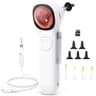 ScopeAround Digital Otoscope Camera with Built-In Video Display Screen
