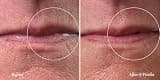 City Beauty City Lips Line Therapy Fortifying Wrinkle Smoothing Serum