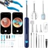 Bebird R1 Ultra Precision Ear Wax Removal Camera with Smart Tweezers