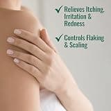 Nizoral Psoriasis Relief Cream with 3% Salicylic Acid and Essential Skin Moisturizers