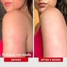 First Aid Beauty KP Bump Eraser Body Scrub Exfoliant with 10% AHA Chemical Exfoliation