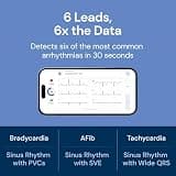 KardiaMobile 6L Max 6-Lead Personal At-Home EKG Monitor with Bluetooth