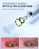 ScopeAround Digital Otoscope with 4.5-Inch IPS Screen and 3.9mm Camera