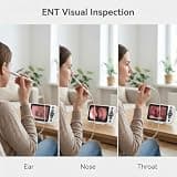 Jytone Digital Otoscope Inspection Kit with 4.5-Inch Screen and 32GB