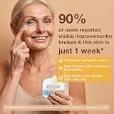 Arnica Extra Strength Bruise & Swelling Relief Cream with Vitamin K (4.23 oz)