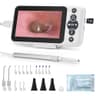 Jytone Digital Otoscope Inspection Kit with 4.5-Inch Screen and 32GB