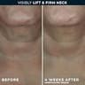 RoC Derm Correxion Firming Neck Cream with Hyaluronic Acid & Advanced Retinol