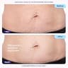 GOPURE Tighten & Smooth Belly Cream with MicroTight4 Complex Formula