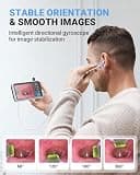 ScopeAround Digital Otoscope with 4.5-Inch IPS Screen and 3.9mm Camera