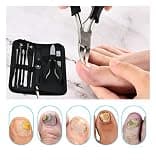 Bcabo 10-Piece Surgical Stainless Steel Ingrown Toenail Treatment Kit