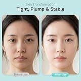 TRSTAY LUXE Stem Cell & Salmon DNA PDRN Serum, 30 Sterile 2mL Vials for Recovery