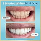 Lumineux Teeth Whitening Strips Kit with Natural Essential Oils, 9 Treatments