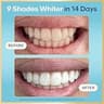Lumineux Teeth Whitening Strips Kit with Natural Essential Oils, 9 Treatments