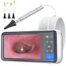 ScopeAround Digital Otoscope with 4.5-Inch IPS Screen and 3.9mm Camera