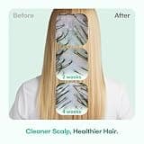 TS GD Teen Shampoo for Itchy, Flaky, Dry, and Sensitive Scalp Relief