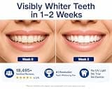 VieBeauti Teeth Whitening Pen Gel Kit with 35% Carbamide & Desensitizing Pen