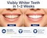 VieBeauti Teeth Whitening Pen Gel Kit with 35% Carbamide & Desensitizing Pen