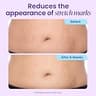 GOPURE Tighten & Smooth Belly Cream with MicroTight4 Complex Formula