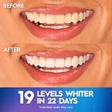 Crest 3D Whitestrips Professional Effects, 44-Strip At-Home Teeth Whitening Treatment