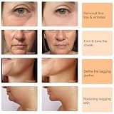 ALUSHEE 6-in-1 Multipolar RF & Microcurrent Skin Tightening Facial Tool