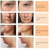 ALUSHEE 6-in-1 Multipolar RF & Microcurrent Skin Tightening Facial Tool