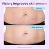 GOPURE Tighten & Smooth Belly Cream with MicroTight4 Complex Formula
