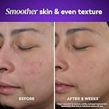 Olay Retinol 24 Night Moisturizer, Anti-Aging Face Cream with Niacinamide, 1.7 oz