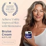 Dermend Arnica Bruise Cream with Vitamin K, Retinol & Ceramides (4.5 oz)
