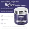 SKINTENSIVE Arnica Bruise Cream for Thin Skin with Vitamin K and Coconut Oil