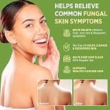 Roycederm Medicated Antifungal Bar Soap with Clotrimazole 1% and Natural Tea Tree Oil