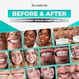 SUNATORIA Teeth Whitening Powder with Activated Coconut Charcoal and Bentonite Clay