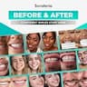 SUNATORIA Teeth Whitening Powder with Activated Coconut Charcoal and Bentonite Clay