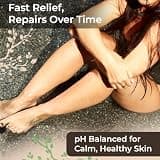Wild Naturals Eczema & Psoriasis Cream with Organic Aloe Vera and Soothing Manuka Honey