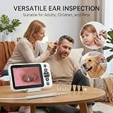 Jytone Digital Otoscope Inspection Kit with 4.5-Inch Screen and 32GB