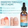 Comprehensive Ingrown Toenail Tool Kit with Corrector Drops and Patches