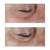 Perricone MD Hypoallergenic Firming Eye Cream for Sensitive and Reactive Skin