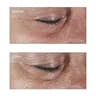 Perricone MD Hypoallergenic Firming Eye Cream for Sensitive and Reactive Skin