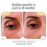 Sensica Sensilift Dynamic Radio Frequency Anti-Aging Skin Tightening Device