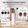 ScopeAround Digital Otoscope Camera with Built-In Video Display Screen