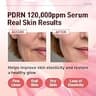 Salmon DNA PDRN 120,000 ppm EGF Peptide Intensive Microneedling Serum for Mature Skin