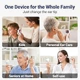 ScopeAround Digital Otoscope Camera with Built-In Video Display Screen