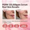 Salmon DNA PDRN 120,000 ppm EGF Peptide Intensive Microneedling Serum for Mature Skin
