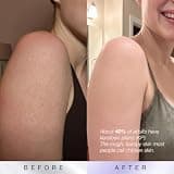 DERMAdoctor KP Bump Eraser Body Scrub with 10% AHA and PHA Chemical Exfoliation
