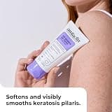 AmLactin KP Bumps Be Gone Therapeutic Body Cream Exfoliator with 15% Lactic Acid