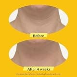 StriVectin TL Advanced Tightening Neck Cream PLUS for Firming & Lifting