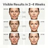 7-Color LED Red Light Therapy Facial Sculptor with Heat, Vibration, and Built-In Timer