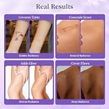 MyTend Body Coverage Perfector Foundation Concealer, Golden Radiance