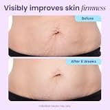 GOPURE Tighten & Smooth Belly Cream with MicroTight4 Complex Formula